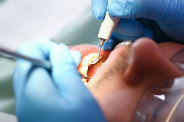 Best Pediatric Emergency Dentist in Cockrell Hill, TX
